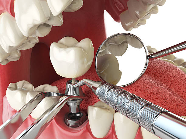 Best Emergency Treatment for Dental Infections or Abscesses in Saukville, WI